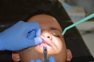 UCNE y Universidad de Bufalo realizan jornada de operativos odontológicos_1