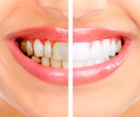 Rehabilitacion Oral